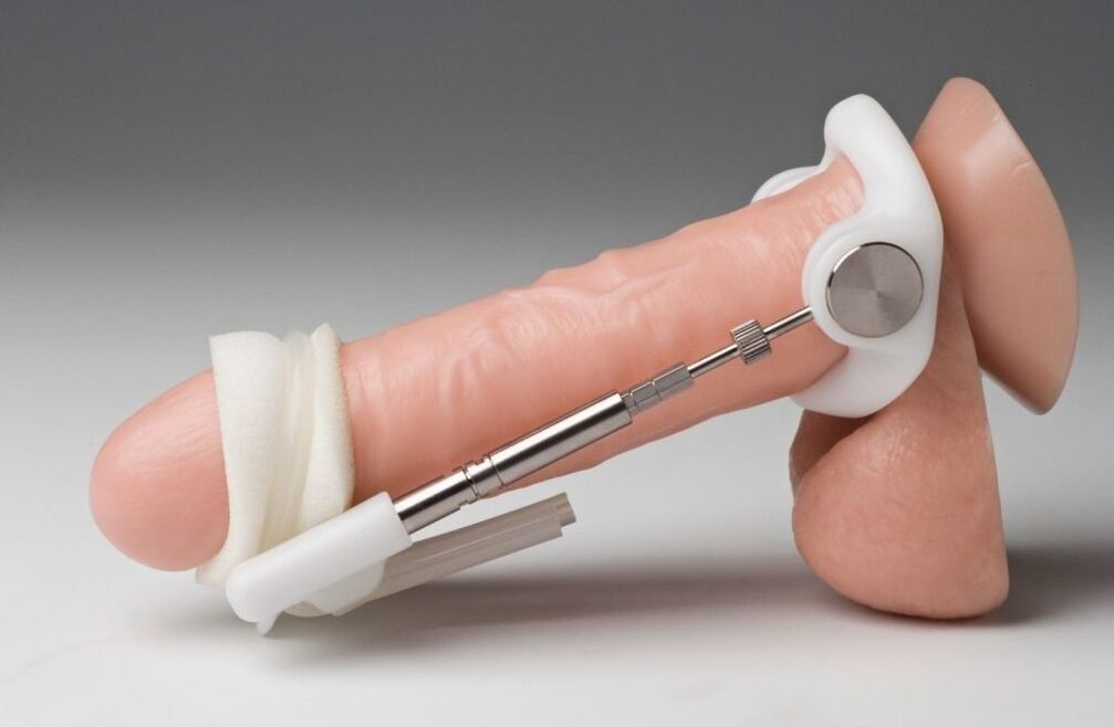 Expand to increase the thickness of the penis